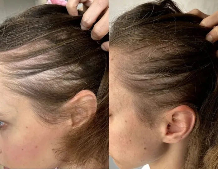 Crowned hair regrowth serum for women
