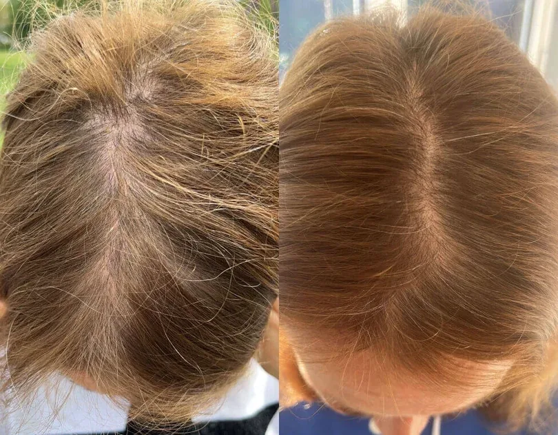 Week 1 and week 12 comparison Week 1 and week 12 comparison