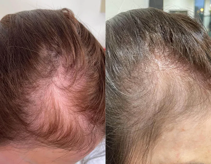 Week 1 and week 12 comparison Week 1 and week 12 comparison