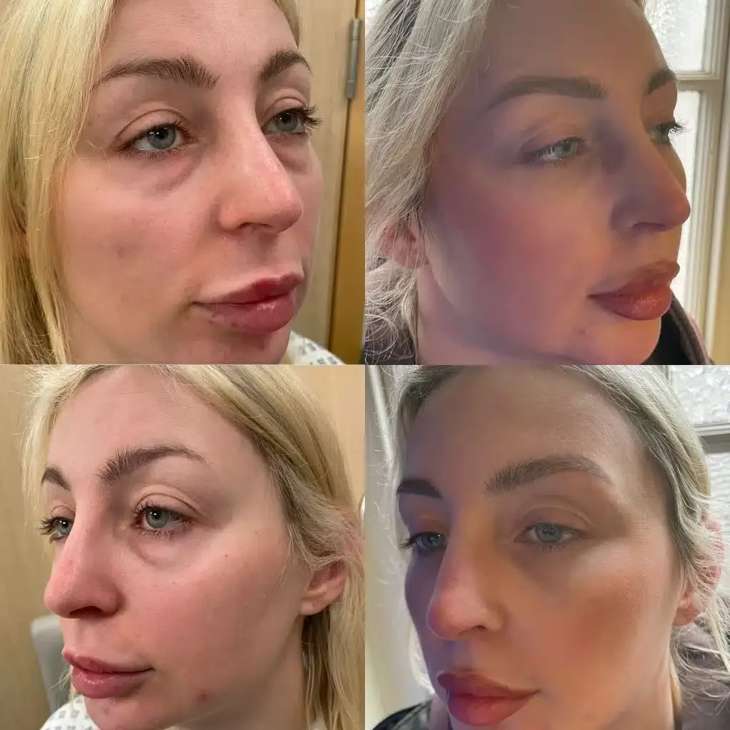 Nicole S. — before and after