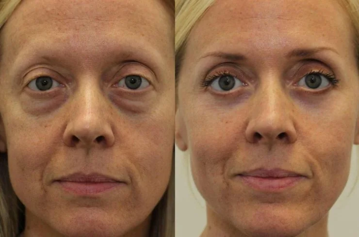 Rebecca T. — before and after